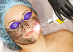 Carbon Facial