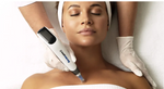 Skin Needling Decolletage